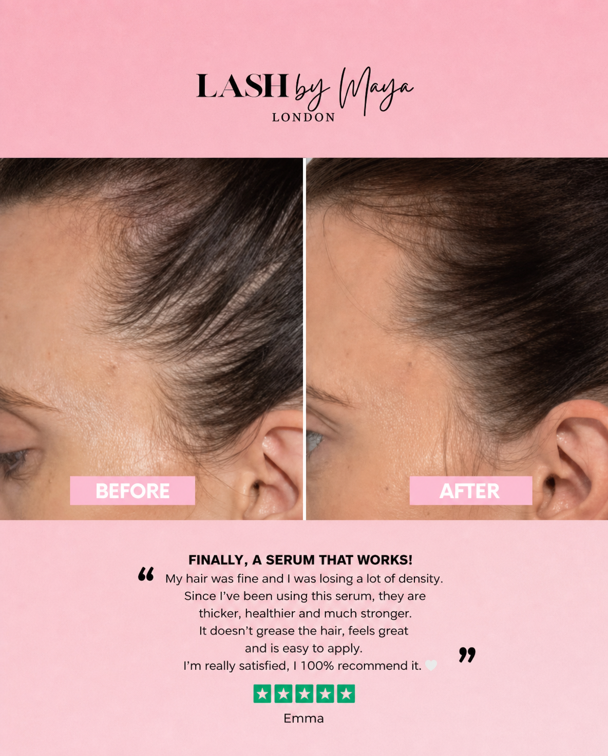 HAIR SERUM